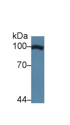 Western Blot; Sample: Recombinant protein.