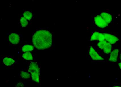 Transportin 1 (TNPO1) Polyclonal Antibody - image 4