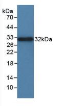 Integrin Alpha D (ITGaD) Polyclonal Antibody - image 2