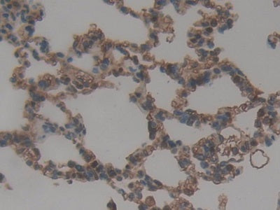 Figure. DAB staining on IHC-P; Samples: Rat Spleen Tissue.