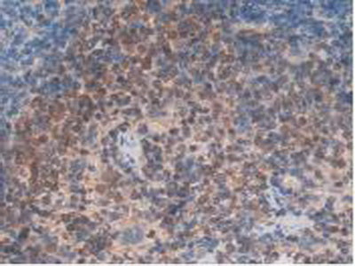 Integrin Alpha D (ITGaD) Polyclonal Antibody - image 4