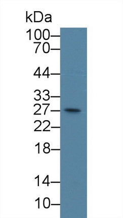 Western Blot; Sample: Recombinant protein.