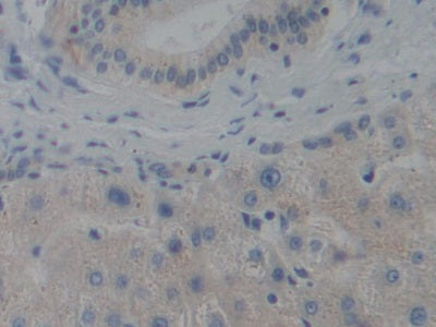Centromere Protein H (CENPH) Polyclonal Antibody - image 5
