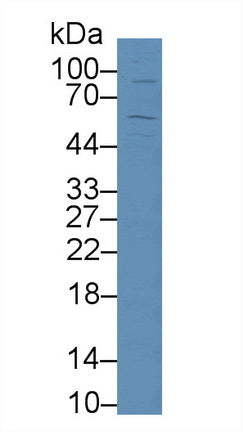 Western Blot; Sample: Recombinant protein.