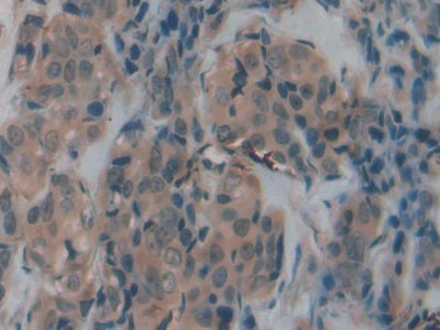 Transferrin Receptor 2 (TFR2) Polyclonal Antibody - image 5