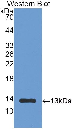 DAB staining on IHC-P; Samples: Rat Kidney Tissue; Primary Ab: 20μg/ml Rabbit Anti-Rat b2M Antibody Second Ab: 2µg/mL HRP-Linked Caprine Anti-Rabbit IgG Polyclonal Antibody