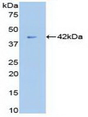 Beta-2-Microglobulin (b2M) Polyclonal Antibody - image 3