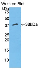 Western Blot; Sample: Lane1: Mouse Liver lysate; Lane2: Mouse Spleen lysate; Lane3: Mouse Brain lysate; Primary Ab: 2µg/ml Rabbit Anti-Mouse ANXA5 Antibody; Second Ab: 0.2µg/ml HRP-Linked Caprine Anti-Rabbit IgG Polyclonal Antibody;