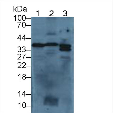 DAB staining on IHC-P; Samples: Mouse Intestine Tissue; Primary Ab: 20µg/ml Rabbit Anti-Mouse ANXA5 Antibody Second Ab: 2µg/mL HRP-Linked Caprine Anti-Rabbit IgG Polyclonal Antibody