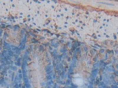 DAB staining on fromalin fixed paraffin- embedded intestine tissue)