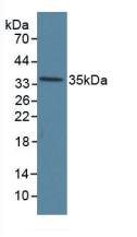 Western Blot; Sample: Caprine Lung lysate Primary Ab: 1.5µg/ml Rabbit Anti-Human ANXA5 Antibody Second Ab: 0.2µg/mL HRP-Linked Caprine Anti-Rabbit IgG Polyclonal Antibody