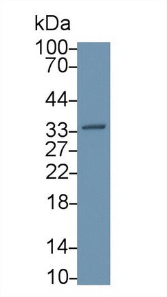 Western Blot; Sample: Recombinant protein.