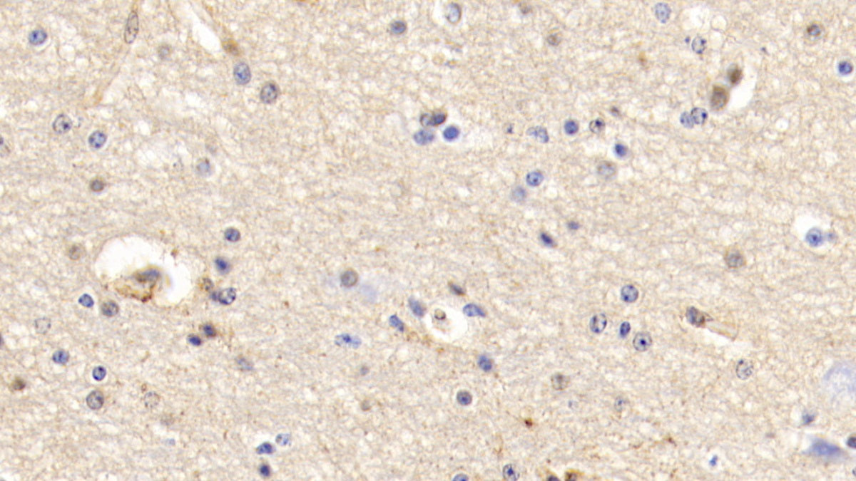 DAB staining on IHC-P; Samples: Human Placenta Tissue; Primary Ab: 20ug/ml Rabbit Anti-Bovine ANXA5 Antibody Second Ab: 2µg/mL HRP-Linked Caprine Anti-Rabbit IgG Polyclonal Antibody