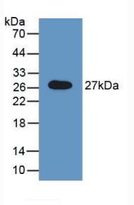 DAB staining on IHC-P; Samples: Rat Kidney Tissue;  Primary Ab: 10µg/ml Rabbit Anti-Rat GAS Antibody