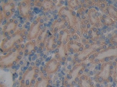 N-Acetylgalactosamine-6-Sulfatase (GALNS) Polyclonal Antibody - image 5