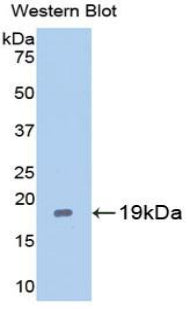 Western Blot; Sample: Lane1: Mouse Cerebrum lysate; Lane2: 293T cell lysate; Lane3: Hela cell lysate; Lane4: Jurkat cell lysate; Lane5: Raji cell lysate; Lane6: Rat Cerebrum lysate; Lane7: Porcine Cerebrum lysate; Lane8: Porcine Liver lysate; Lane9: Human Placenta lysate; Lane10: Human Lung lysate; Primary Ab: 0.2μg/ml Rabbit Anti-Mouse CASP2 Antibody; Second Ab: 0.2µg/mL HRP-Linked Caprine Anti-Rabbit IgG Polyclonal Antibody;