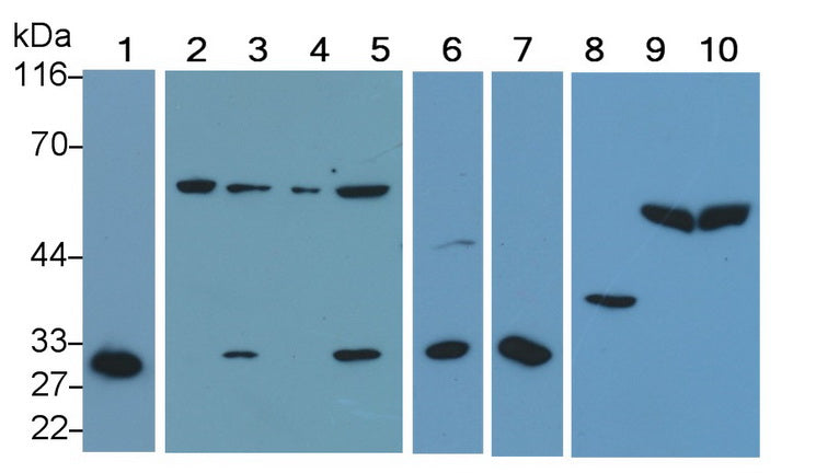 DAB staining on IHC-P; Samples: Mouse Kidney Tissue;  Primary Ab: 20μg/ml Rabbit Anti-Mouse CASP2 Antibody Second Ab: 2µg/mL HRP-Linked Caprine Anti-Rabbit IgG Polyclonal Antibody