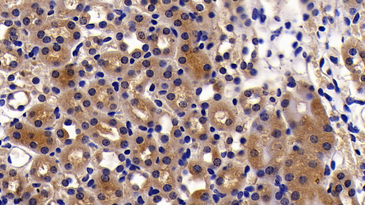 Caspase 2 (CASP2) Polyclonal Antibody - image 4