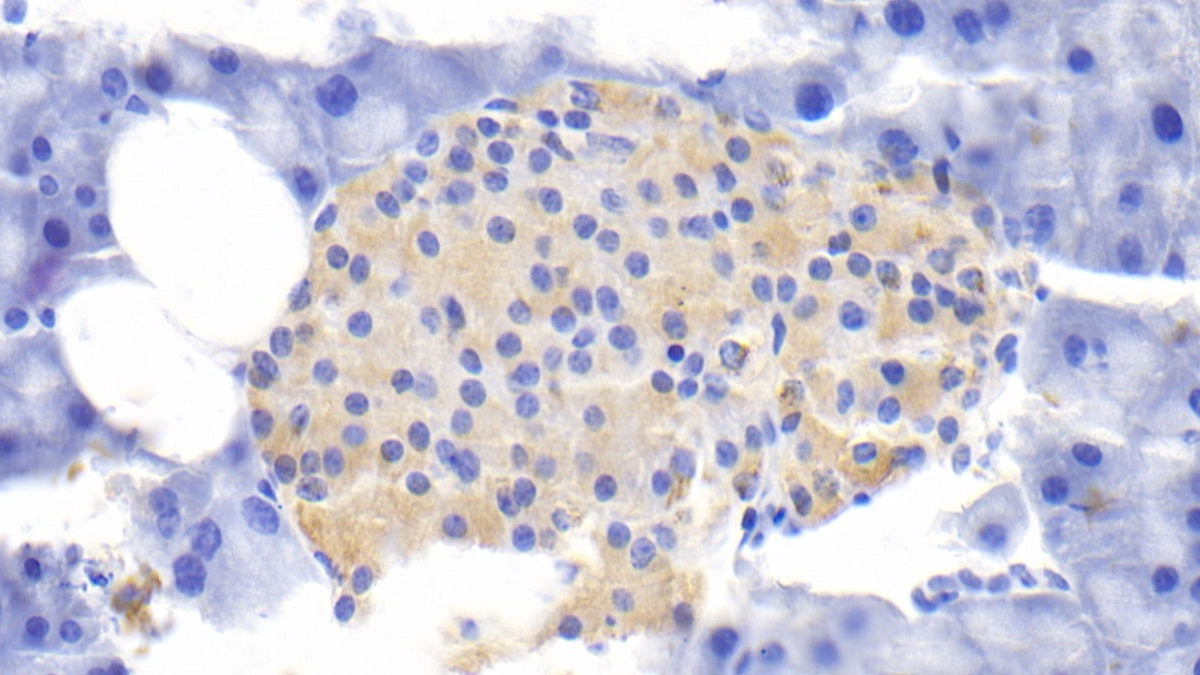 DAB staining on fromalin fixed paraffin-embedded Liver tissue)