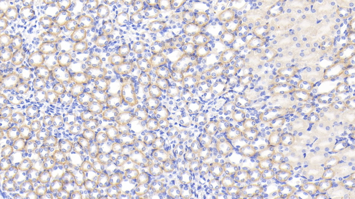 Interleukin 1 Receptor Antagonist (IL1RA) Polyclonal Antibody - image 4