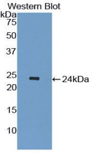 Interleukin 1 Receptor Antagonist (IL1RA) Polyclonal Antibody - image 2