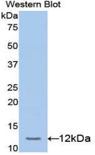 Transcription factor 20 (TCF20) Polyclonal Antibody - image 2