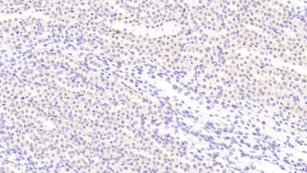 DABstainingonIHC-P.Samples:RatTissue)
