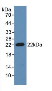 Used in DAB staining on fromalin fixed paraffin-embedded Kidney tissue