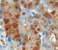 Adrenomedullin (ADM) Polyclonal Antibody - image 4