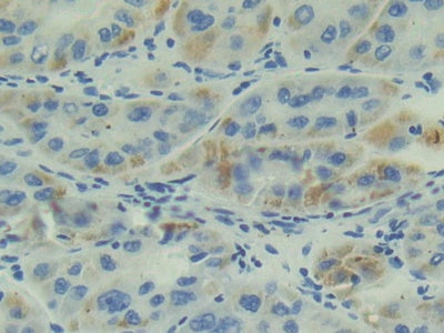 DAB staining on IHC-P; Samples: Human Liver Tissue