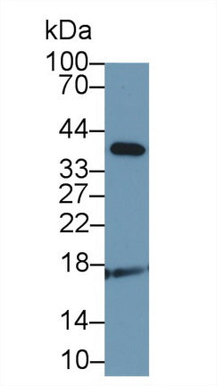 Western Blot; Sample: Recombinant protein.