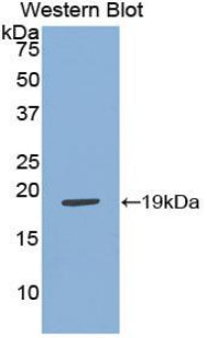 Adrenomedullin (ADM) Polyclonal Antibody - image 3