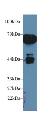 Western Blot; Sample: Recombinant protein.