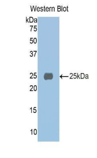 DAB staining on IHC-P; Samples: Rat Cerebellum Tissue; Primary Ab: 10μg/ml Rabbit Anti-Rat a1M Antibody Second Ab: 2µg/mL HRP-Linked Caprine Anti-Rabbit IgG Polyclonal Antibody