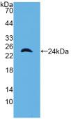 DAB staining on IHC-P; Samples: Mouse Kidney Tissue;  Primary Ab: 20µg/ml Rabbit Anti-Mouse a1M Anti