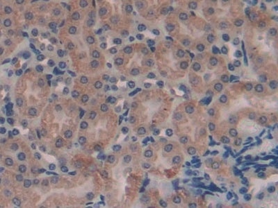 Alpha-1-Microglobulin (a1M) Polyclonal Antibody - image 5