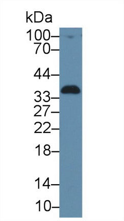 Western Blot; Sample: Recombinant protein.