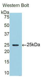 DAB staining on IHC-P; Samples: Human Kidney Tissue;  Primary Ab: 20µg/ml Rabbit Anti-Human a1M Anti