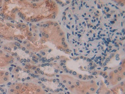 Alpha-1-Microglobulin (a1M) Polyclonal Antibody - image 5