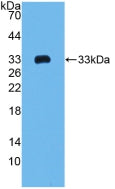 DAB staining on IHC-P; Samples: Mouse Spleen Tissue;  Primary Ab: 20µg/ml Rabbit Anti-Mouse COL1a2 A