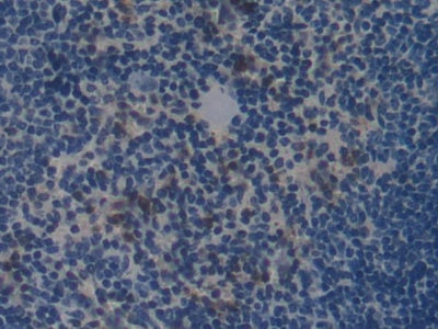 Collagen Type I Alpha 2 (COL1a2) Polyclonal Antibody - image 5