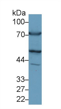 Western Blot; Sample: Recombinant protein.