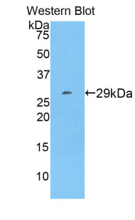 DAB staining on IHC-P; Samples: Rat Liver Tissue;  Primary Ab: 10µg/ml Rabbit Anti-Rat ALT Antibody