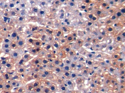 DAB staining on IHC-P; Samples: Rat Liver Tissue)