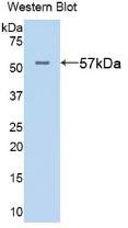 Alanine Aminotransferase (ALT) Polyclonal Antibody - image 2