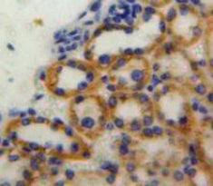 Alanine Aminotransferase (ALT) Polyclonal Antibody - image 3