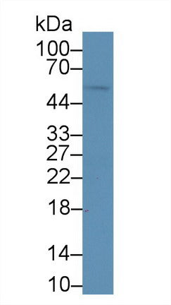 Western Blot; Sample: Recombinant protein.