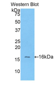 DAB staining on IHC-P; Samples: Porcine Liver Tissue;  Primary Ab: 20µg/ml Rabbit Anti-Porcine ALT A