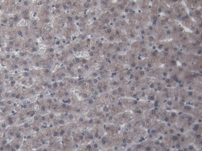Alanine Aminotransferase (ALT) Polyclonal Antibody - image 4