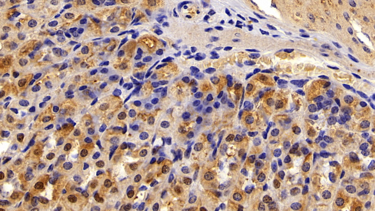 Alanine Aminotransferase (ALT) Polyclonal Antibody - image 4